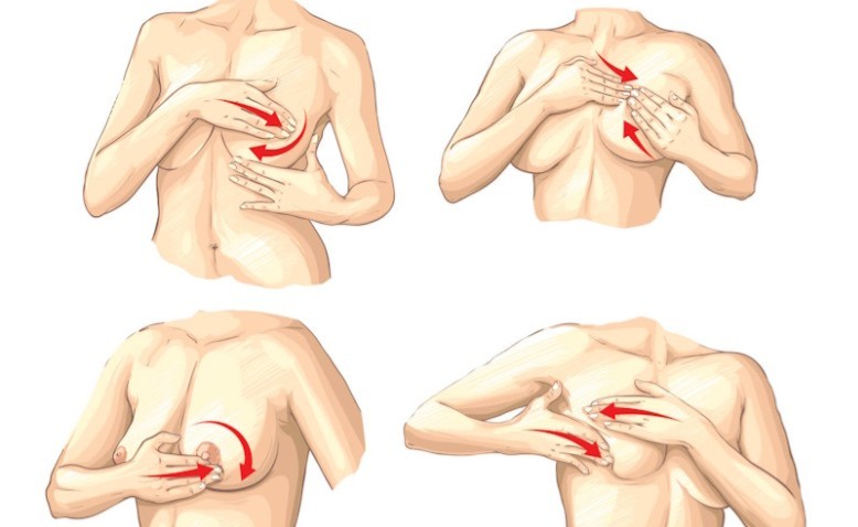 Prevención del cáncer de mama, más allá de tocarse las tetas